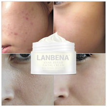 Load image into Gallery viewer, Snail Repair Whitening Facial Cream. Day Cream, Anti Wrinkle ,Anti Aging Acne Treatment Moisturizing Firming Skin Care 30g