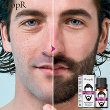Load image into Gallery viewer, Hair Follicle and Repair Oil for Men. Styling Oil Hair for Growth Of Beard Hair. Care Moisturizing Smoothing 10ml