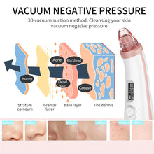 Load image into Gallery viewer, Blackhead Remover Vacuum Pore, Acne, and Pimple Remover. Nose and Face Deep Cleansing Machine. total facial cleanser
