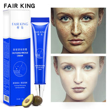 Load image into Gallery viewer, Dark Spot Corrector,  Skin Whitening and Fade Cream Lightening Blemish Removal Serum Reduces Age Spots Freckles Face Cream 20g
