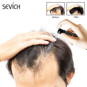 30ml Hair Growth Essence Spray for Hair Loss and Damaged Hair.   Repair Growing Original Authentic Hair Loss Treatment