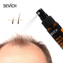 Load image into Gallery viewer, 30ml Hair Growth Essence Spray for Hair Loss and Damaged Hair.   Repair Growing Original Authentic Hair Loss Treatment
